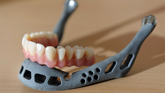 Новый метод получения искусственной челюсти более безопасен, снижает брак и стоимость имплантата. Фото: Universiteit Hasselt