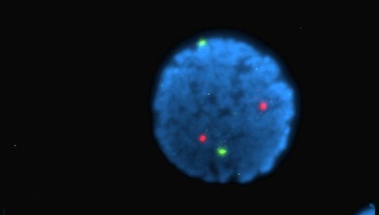 Lymphocyte nucleus marked with fluorescent dyes. Photo: “Wikipedia”