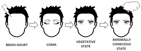 Fig. 1. Recovery process after brain trauma. Credit: Yuri Pavlov